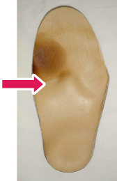 足に合わせた中敷き