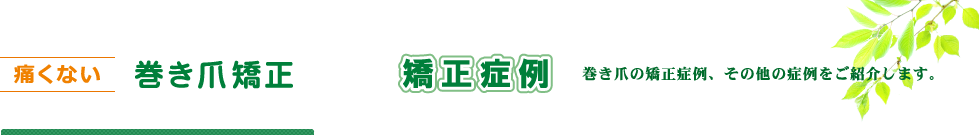 痛くない巻き爪矯正　矯正症例　巻き爪の矯正症例、その他の症例をご紹介します。